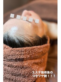 エンチャント(ENCHANT+)/韓国肌管理が人気です！