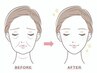 たるんだお肌、フェイスライン復活！！いまだけ半額☆