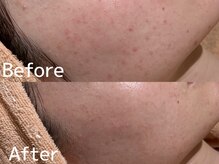 カレンジェビューティー(CarengeBeauty)/プラチナクレイピール