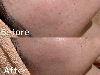 カレンジェビューティー(CarengeBeauty)/プラチナクレイピール