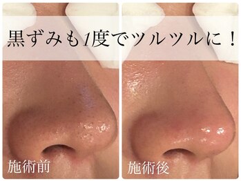 ビーフリー(Be free)