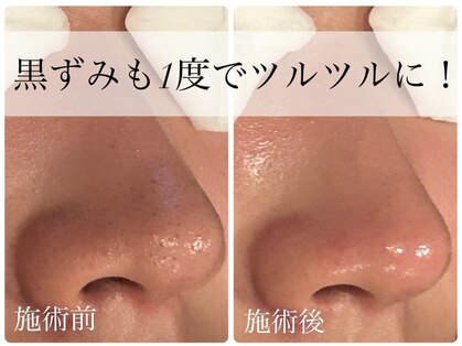 ビーフリー(Be free)の写真
