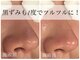 ビーフリー(Be free)の写真