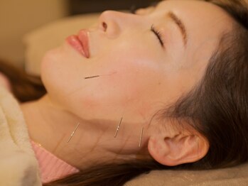 縁座や(ENZAYA)/お試し美容鍼