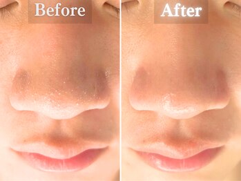 ボーンオム(Born Homme)