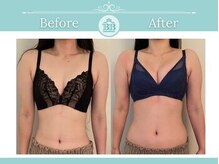 美人バスト 新潟店/ 【バストアップ★育乳】症例