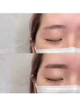 ダフネ(DAFNE)/垂れ眉解消