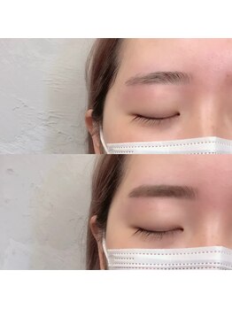 ダフネ(DAFNE)/垂れ眉解消