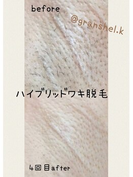 グランシェル(GRANSHEL)/