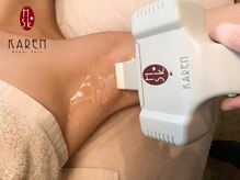 カレン 沖縄宜野湾店/脱毛お手入れ3