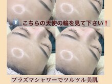 ジュエルボンド(Jewel Bond)/【肌質改善】ツルツル美肌