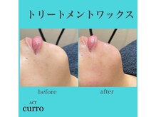 アクト クロ(ACT curro)/【フェイシャル】施術例
