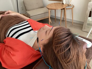 ハリファ鍼灸院 横浜関内院(HariFa鍼灸院)/美容施術