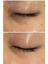 ロッシュ フェイス(Roche Face)/30代女性