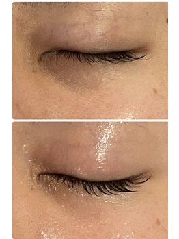 ロッシュ フェイス(Roche Face)/30代女性