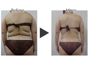 サロン ド チョコ(SALON DU CHOCO)/痩身全身