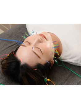 鍼灸施術を受けたい