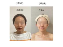 マノン(Manon)の雰囲気（1年後の変化！身体やお顔の調子が良いのが当たり前に(^^)）