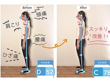 みふく整体院の雰囲気（施術前の姿勢をパシャリ！どんな歪みがあるのか確認）