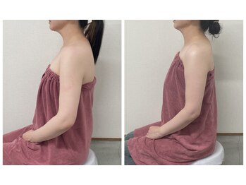 ブリランテ(Brillante)/