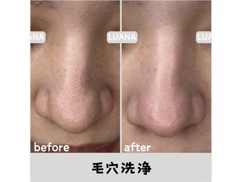 ルアナ 北谷店/毛穴洗浄毛穴ケア 《沖縄/北谷》