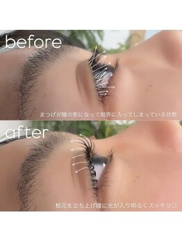 ビューティーグロウ(BEAUTY-GROW)/