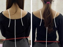 すこやかBB腰痛整体