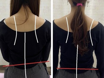 すこやかBB腰痛整体の写真/◆院長【瑞稀式矯正◇初回¥18,000⇒¥11,000】姿勢矯正◆歪みが整うと痛み改善・不調予防・集中力Upにも。