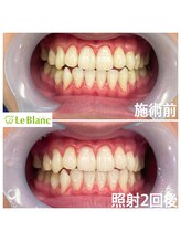 ルブラン 奈良店(Le Blanc)/男性のお客様も通いやすい