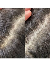 シュール センター南(SURREAL)/ヘッドスパ後のビフォーアフター