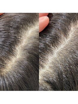 シュール センター南(SURREAL)/ヘッドスパ後のビフォーアフター