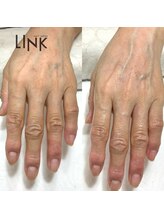 リンク(LINK)/ハンドエステ