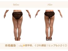 アランルージュ(ALANROUGE)/劇的★ビフォーアフター