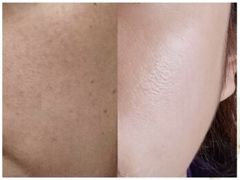 ティアラビューティ/会社帰りでもOK