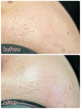 ケースタイル(k.style)/ブラックカーボンフォト