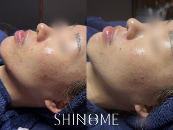 シノノメ(SHINONOME)/*お肌のハリつやケア