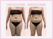 スリムライン 弘前店(The Slim Line)/before→after