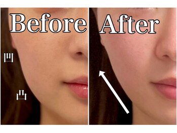 モッチ 天神大名店(MOCCHI)