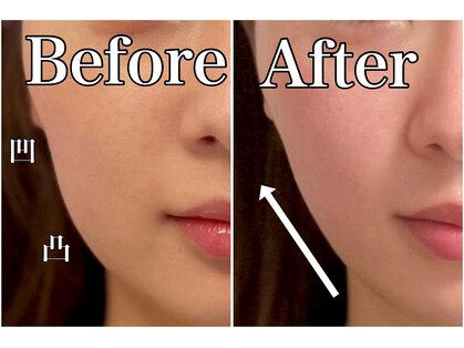 モッチ 天神大名店(MOCCHI)の写真