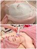 【極上☆石膏パックフェイシャル☆】石膏パック&ハイパーナイフW効果90分