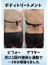 ちゅらゆき/美容カイロ