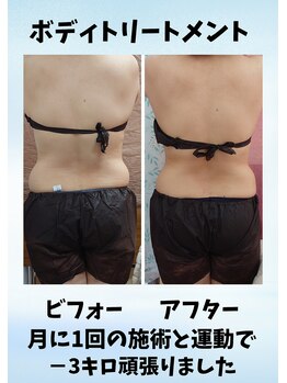 ちゅらゆき/美容カイロ