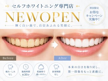 ホワイトニングサロンBLANC.【ブラン】の写真/ ６月OPEN【初めてのホワイトニング2500円】圧倒的白さ★高出力マシン×高濃度ジェルを駅ちかサロンで♪
