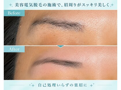 エミルーチェ(emiluce)の写真