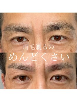 ビオプラス(BIO PLUS)/【眉毛】デザインWAX脱毛