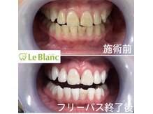 ルブラン 奈良店(Le Blanc)/自信を持って笑えるように！！