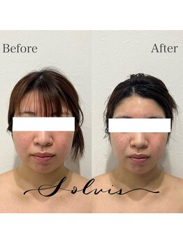 ソルヴィス(SOLVIS)/