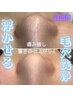 7.8月限☆仕上がり最強、肌負担ゼロの長野初、浮かせる毛穴洗浄￥7,500