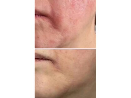 マリエンドリーの写真