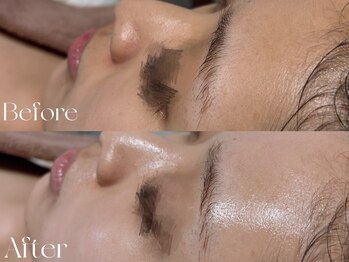 ウィハナ(wehana)/【ララピール】くすみ/透明感